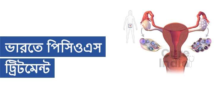 ভারতে পিসিওএস ট্রিটমেন্ট